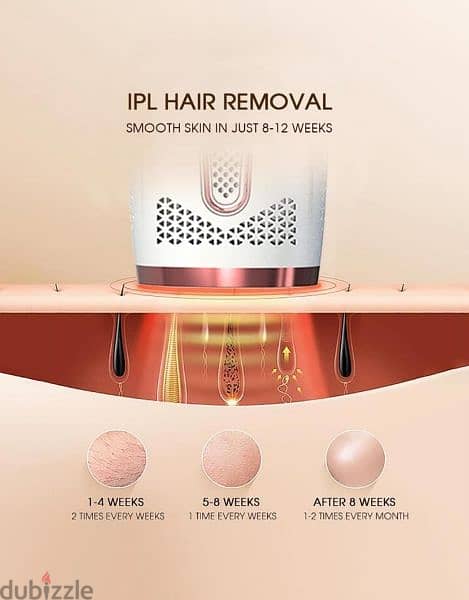 Ipl Laser Hair remover 1