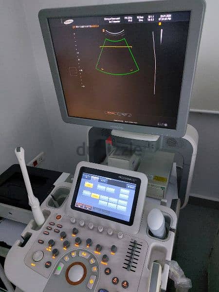 Accuvix XG ultrasound 1