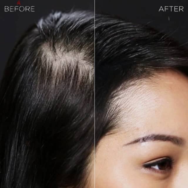 Toppik Hair Filler 3-in-1 for Thinning Hair and Receding Hairline 4