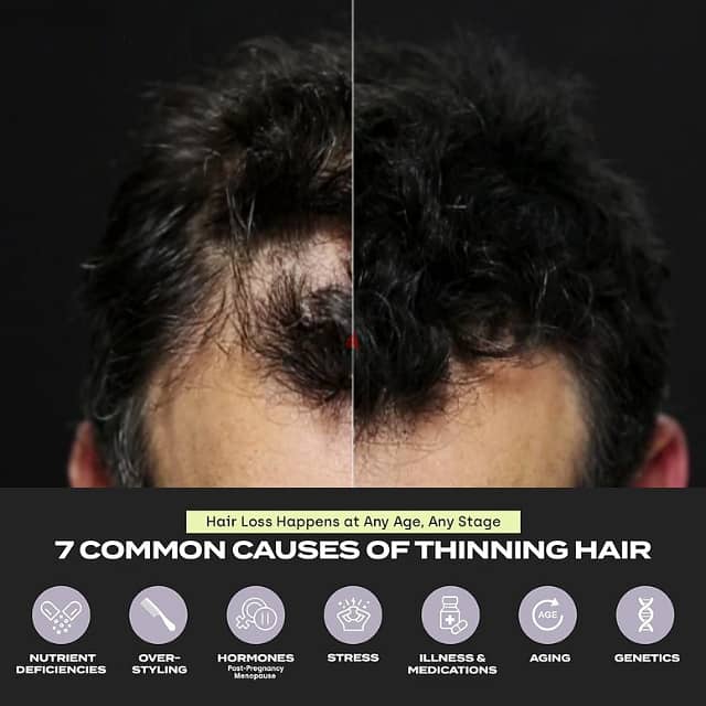 Toppik Hair Filler 3-in-1 for Thinning Hair and Receding Hairline 10