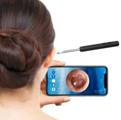 endoscope/ otoscope  كاميرا فحص  وتنظيف شمع الاذن 0