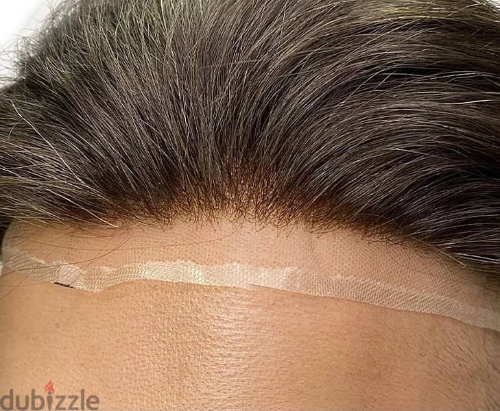 Hair replacement تركيب شعر مستعار 4