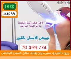 تبييض اسنان بالليزر teeth whitening 0