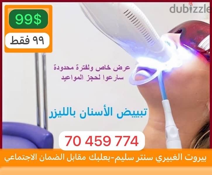 تبييض اسنان بالليزر teeth whitening 0