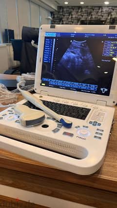 ultrasound machine