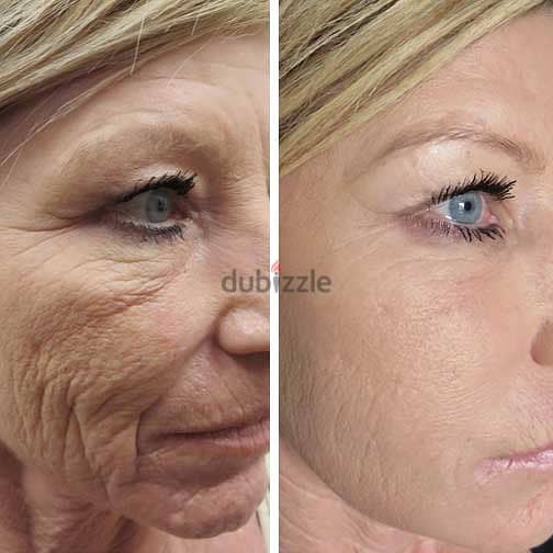 Instant botox face cream 0