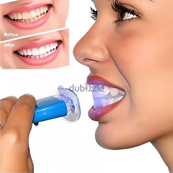 TEETH WHITENING KIT 1