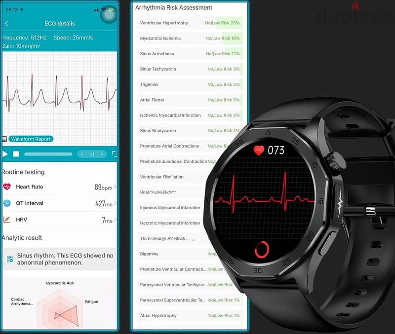 Smart Watch Health Monitor 13