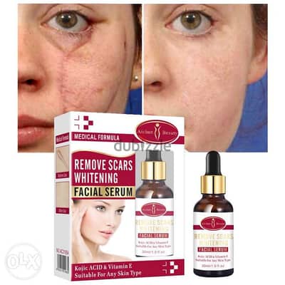 ‏Aichun Beauty Medical Formula Remove Scars