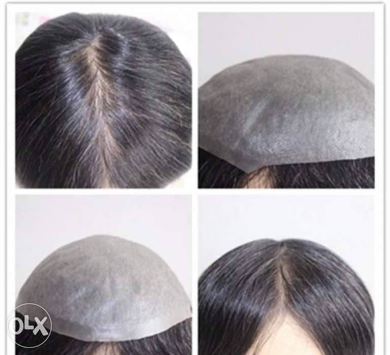 hair replacement for men 3