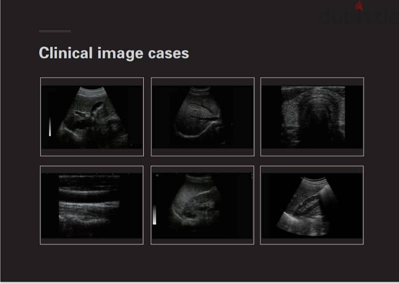 Ultrasound Dawei- 2 Probes 2