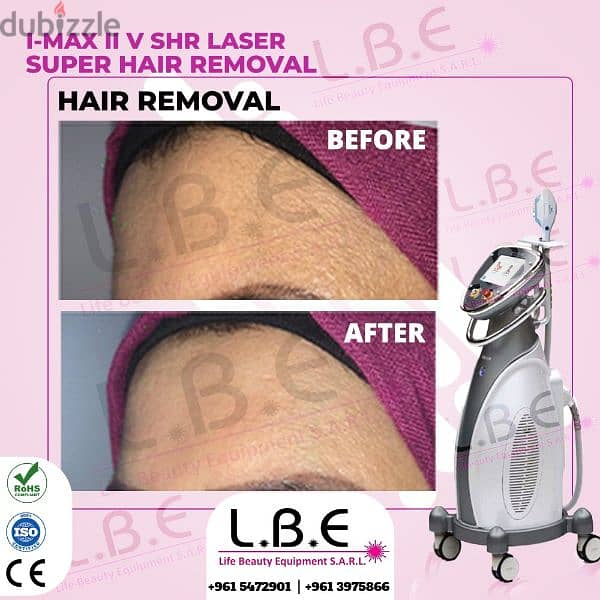 Buy or rent SHR laser super hair removal best quality models 2023 1