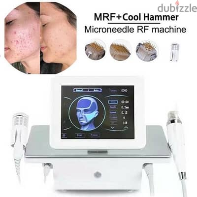 FRACTIONAL RADIOFREQUENCY (RF) MICRONEEDLING MACHINE